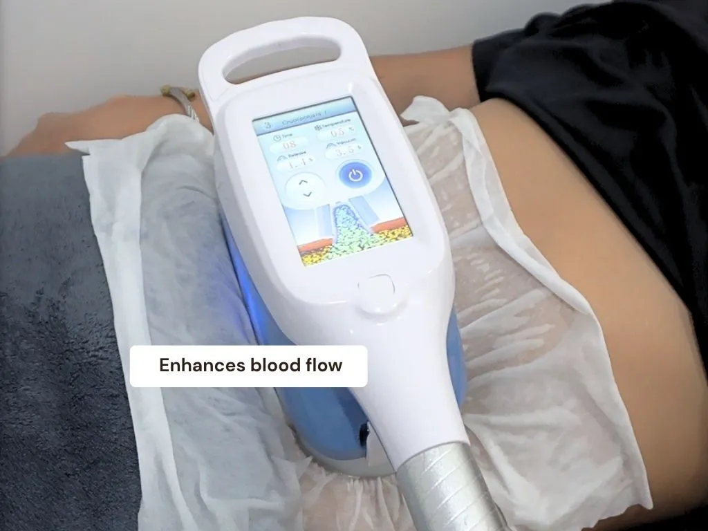 Cryotherapy detail