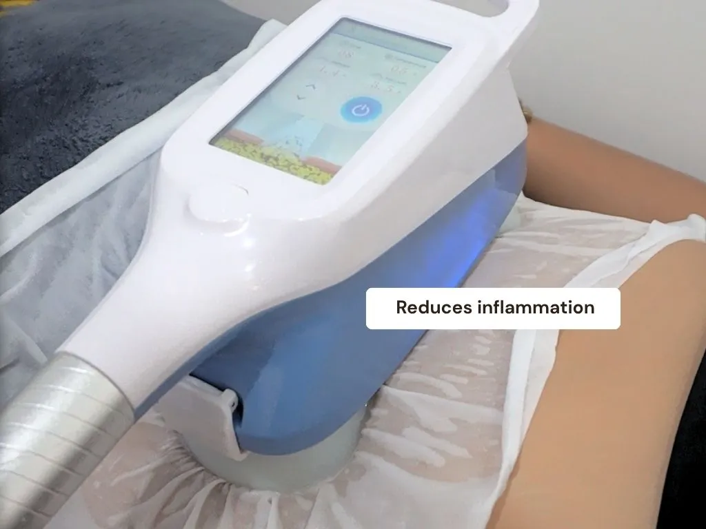 Cryotherapy result