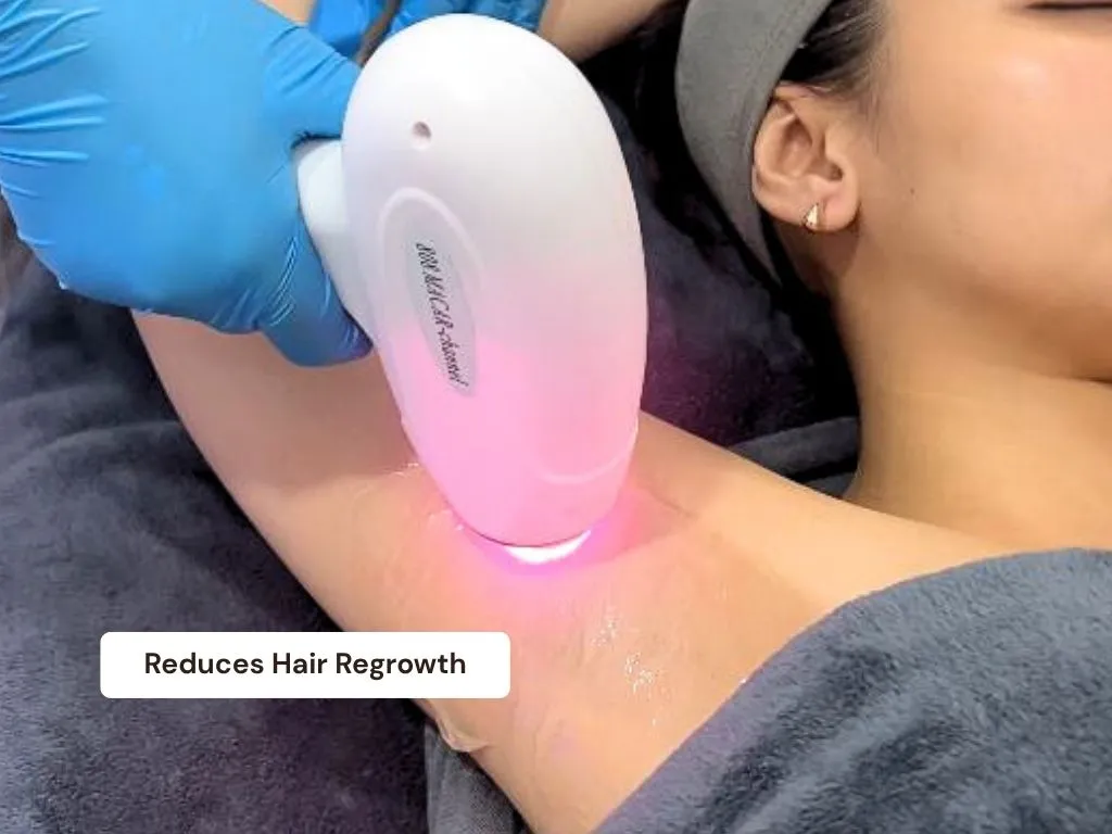 Diode Laser detail