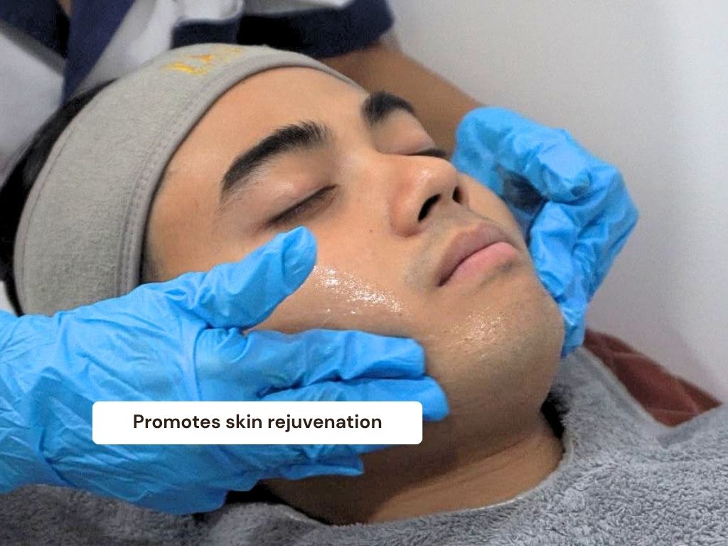 Hydrafacial