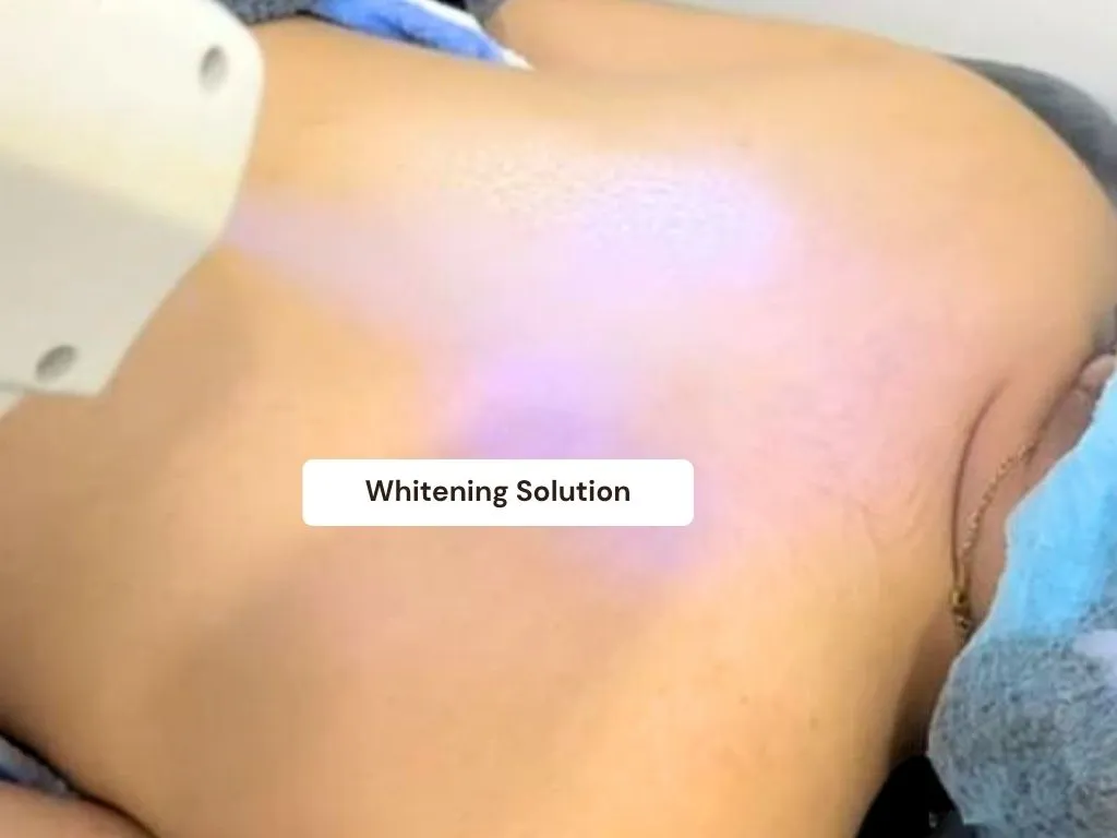 Skin Lightening